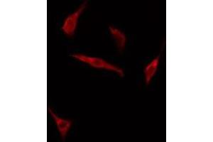 ABIN6275159 staining HuvEc cells by IF/ICC. (GRB14 antibody  (Internal Region))