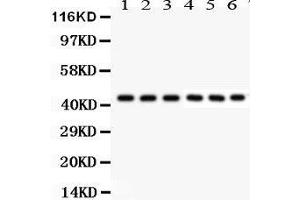 Western Blotting (WB) image for anti-KIN, Antigenic Determinant of RecA Protein Homolog (KIN) (AA 3-202) antibody (ABIN3042474) (KIN antibody  (AA 3-202))