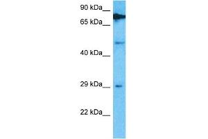 Host:  Rabbit  Target Name:  TRMT61B  Sample Type:  Hela Whole Cell lysates  Antibody Dilution:  1. (TRMT61B antibody  (C-Term))