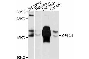 Western blot analysis of extracts of various cell lines, using CPLX1 antibody (ABIN5997502) at 1:3000 dilution.