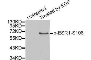 Western blot analysis of extracts from MCF7 cells, using Phospho-ESR1-S106 antibody. (Estrogen Receptor alpha antibody  (pSer106))
