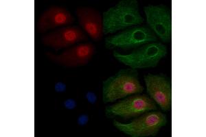 ABIN6258930 and ABIN6275667 staining Hela cells by IF/ICC.