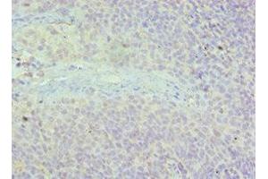 Immunohistochemistry of paraffin-embedded human tonsil tissue using ABIN7143615 at dilution of 1:100 (Adracalin antibody  (AA 287-546))
