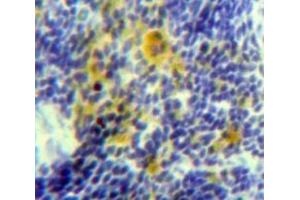 #VALUE! (IL-15 antibody  (AA 48-162))