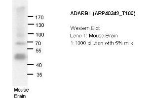 Image no. 2 for anti-Adenosine Deaminase, RNA-Specific, B1 (ADARB1) (N-Term) antibody (ABIN183933) (RED1 antibody  (N-Term))