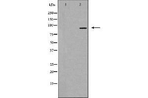 Western blot analysis of extracts from HUVEC cells, using RBM5 antibody. (RBM5 antibody  (N-Term))