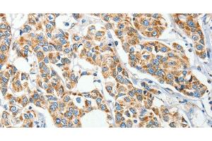 IFT74 antibody