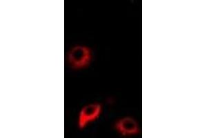 Immunofluorescent analysis of NNMT staining in Hela cells. (NNMT antibody)