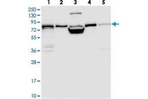 Western blot analysis of Lane 1: RT-4, Lane 2: U-251 MG, Lane 3: Human Plasma, Lane 4: Liver, Lane 5: Tonsil with PEX5 polyclonal antibody  at 1:250-1:500 dilution.