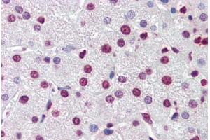 Immunohistochemistry (Paraffin-embedded Sections) (IHC (p)) image for anti-Nuclear Receptor Subfamily 1, Group H, Member 3 (NR1H3) (C-Term) antibody (ABIN462212)