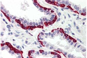 Human Prostate (formalin-fixed, paraffin-embedded) stained with DAPK2 antibody ABIN214481 at 5 ug/ml followed by biotinylated goat anti-rabbit IgG secondary antibody ABIN481713, alkaline phosphatase-streptavidin and chromogen. (DAPK2 antibody  (C-Term))