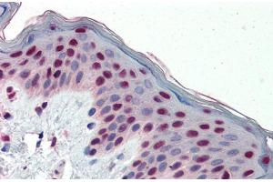 Immunohistochemistry with Human Skin lysate tissue at an antibody concentration of 5. (FOSL1 antibody  (Middle Region))