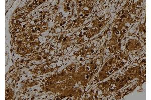 ABIN6275528 at 1/100 staining Human kidney tissue by IHC-P. (STK32C antibody  (Internal Region))