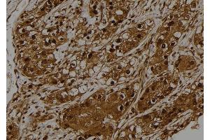 ABIN6275528 at 1/100 staining Human kidney tissue by IHC-P.