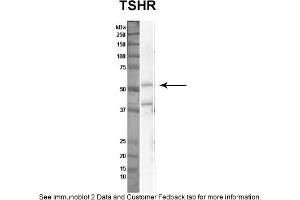 Sample Type: Nthy-ori cell lysate (50ug)Primary Dilution: 1:1000Secondary Antibody: anti-rabbit HRPSecondary Dilution: 1:2000Image Submitted By: Anonymous (TSH receptor antibody  (N-Term))