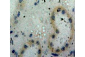 Used in DAB staining on fromalin fixed paraffin-embedded Kidney tissue (PPIA antibody  (AA 2-164))