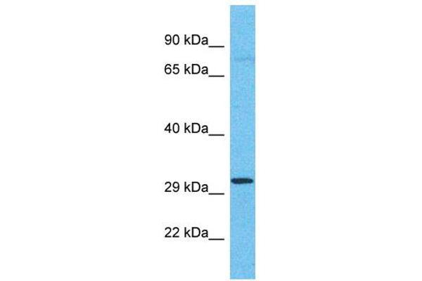 OR4C11 anticorps  (C-Term)