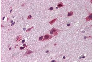 Human Brain Cortex (formalin-fixed, paraffin-embedded) stained with TNIP2 antibody ABIN290395 at 5 ug/ml followed by biotinylated goat anti-rabbit IgG secondary antibody ABIN481713, alkaline phosphatase-streptavidin and chromogen. (TNIP2 antibody)