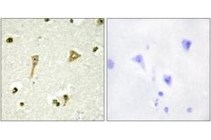 Immunohistochemistry analysis of paraffin-embedded human brain tissue, using TSC22D1 Antibody. (TSC22D1 antibody  (AA 71-120))