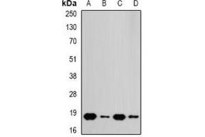Western blot analysis of RPS10 expression in A549 (A), HT29 (B), mouse spleen (C), mouse heart (D) whole cell lysates. (RPS10 antibody)