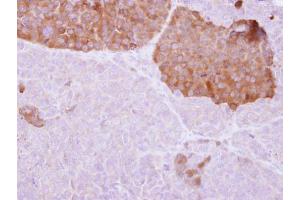 IHC-P Image IL22 Receptor alpha 2 antibody detects IL22RA2 protein at cytosol on PC14 xenograft by immunohistochemical analysis. (IL22RA2 antibody)