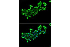 Immunofluorescence analysis of HeLa cells using FLOT1 antibody (ABIN1882347). (Flotillin 1 antibody)