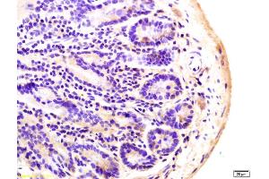 Formalin-fixed and paraffin embedded mouse colon labeled with Anti-ADCY8 Polyclonal Antibody, Unconjugated (ABIN751228) at 1:200 followed by conjugation to the secondary antibody and DAB staining. (ADCY8 antibody  (AA 151-250))