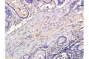 L1 rat lung lysates L2 human colon carcinoma lysates probed with Anti TIMP-1 Polyclonal Antibody, Unconjugatedat 1:200 overnight at 4 °C. (TIMP1 antibody  (AA 131-207))