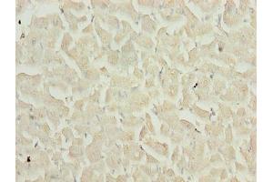 Immunohistochemistry of paraffin-embedded human heart tissue using ABIN7159481 at dilution of 1:100 (TIMP1 antibody  (AA 24-207))