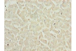 Immunohistochemistry of paraffin-embedded human heart tissue using ABIN7159481 at dilution of 1:100
