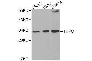 Western blot analysis of extracts of various cell lines, using THPO antibody. (Thrombopoietin antibody  (AA 22-349))