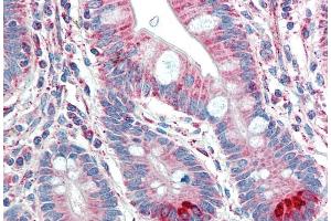 ABIN184703 (5µg/ml) staining of paraffin embedded Human Small Intestine. (TMPRSS5 antibody  (C-Term))