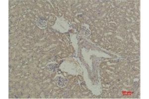 Immunohistochemistry (IHC) analysis of paraffin-embedded Mouse KidneyTissue using STAT5a Rabbit Polyclonal Antibody diluted at 1:500.