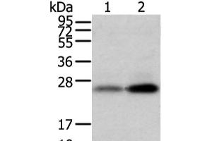 Western blot analysis of Mouse trachea and brain tissue using WFDC5 Polyclonal Antibody at dilution of 1:1100