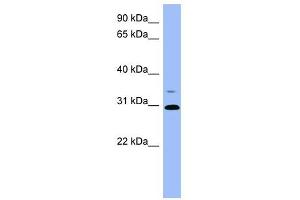 PSPH antibody used at 1 ug/ml to detect target protein.