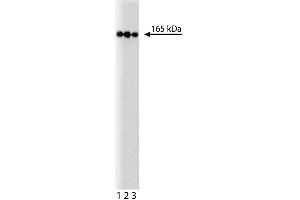 Western blot analysis of PI3-Kinase C2beta on a HeLa lysate. (PIK3C2B antibody  (AA 16-209))