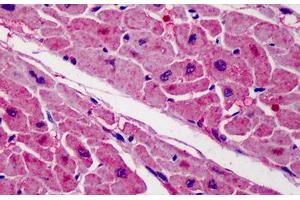 Human Heart: Formalin-Fixed, Paraffin-Embedded (FFPE) (ZBTB7A antibody  (C-Term))
