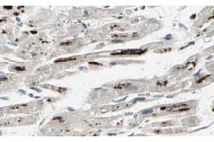 Image no. 2 for anti-Protein Phosphatase 1, Regulatory Subunit 13 Like (PPP1R13L) (AA 780-797), (Isoform 1) antibody (ABIN401339) (PPP1R13L antibody  (Isoform 1))