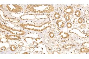 Detection of CRYl1 in Human Kidney Tissue using Polyclonal Antibody to Crystallin Lambda 1 (CRYl1) (CRYL1 antibody  (AA 24-232))