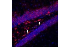 Expression of Kir6. (KCNJ11 antibody  (C-Term, Intracellular))
