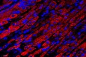 Immunofluorescent analysis of paraformaldehyde-fixed mouse stomach using,NCKAP1 (ABIN7074784) at dilution of 1: 1000 (NCKAP1 antibody)