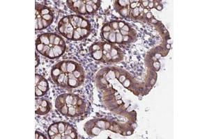 Immunohistochemical staining of human colon with FAM125A polyclonal antibody  shows moderate cytoplasmic and membranous positivity in glandular cells at 1:50-1:200 dilution. (FAM125A antibody)