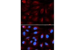 Immunofluorescence (IF) image for anti-Protein Inhibitor of Activated STAT, 2 (PIAS2) antibody (ABIN1876855)