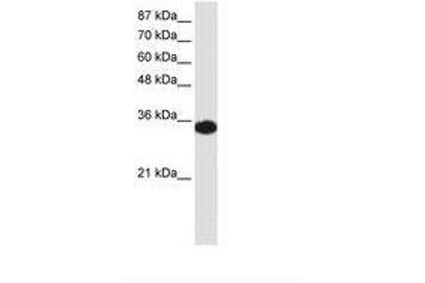 HOXD4 antibody  (C-Term)