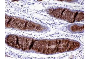 IHC analysis of MUC2 using anti-MUC2 antibody . (MUC2 antibody)