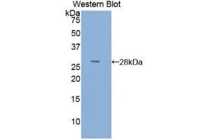 Detection of Recombinant ACTC1, Human using Anti-Actin Alpha 1, Cardiac Muscle (ACTC1) Polyclonal Antibody (ACTC1 antibody  (AA 156-368))