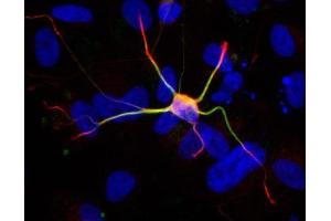 ICC/IF Image Immunofluorescent staining of neurons derived from human ESC with a 1:200 dilution of GeneTex anti-doublecortin antibody, Anti-doublecortin antibody (red) colocalizes with anti-MAP2 antibody (green). (Doublecortin antibody)