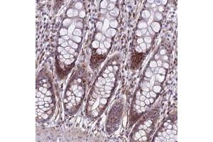 Immunohistochemical staining of human rectum with SAPCD2 polyclonal antibody  shows moderate cytoplasmic and nuclear positivity in glandular cells. (SAPCD2 antibody)