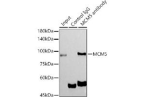 Immunoprecipitation (IP) image for anti-Minichromosome Maintenance Complex Component 5 (MCM5) antibody (ABIN7268543)