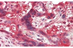Detection of TF in Human Placenta Tissue using Monoclonal Antibody to Tissue Factor (TF) (Tissue factor antibody  (AA 30-252))